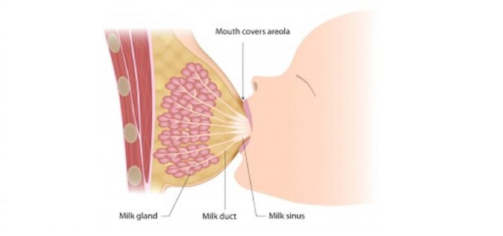 شیردهی پس از پروتز سینه