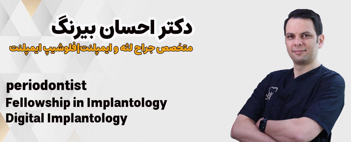 آقای دکتر احسان بیرنگ: متخصص ایمپلنت دیجیتال به روش دیجیتال در تهران