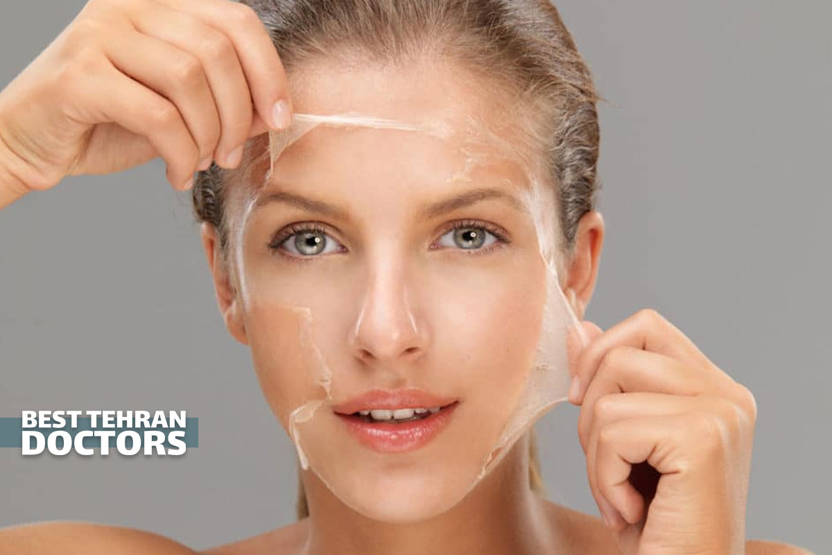 لایه برداری شیمیایی پوست چیست و چه مزایا و معایبی دارد؟