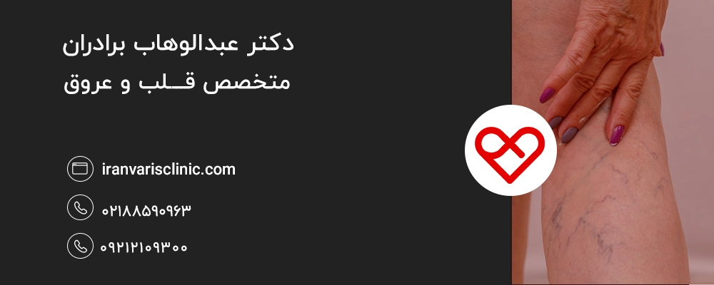 واریس چیست و چرا در بارداری ظاهر می‌شود؟