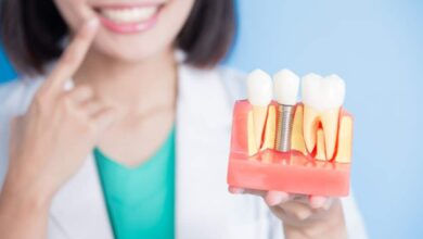 بهترین دکتر ایمپلنت دندان در تهران | معرفی 7 کلینیک + آدرس و شماره تماس